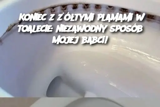 Koniec z żółtymi plamami w toalecie: niezawodny sposób mojej babci!