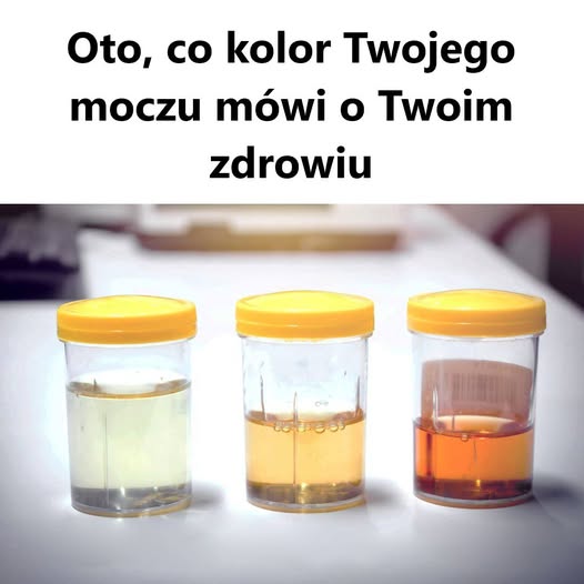 Oto, co kolor Twojego moczu mówi o Twoim zdrowiu