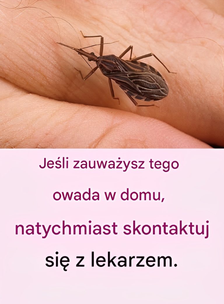 Ten niewielki, mało znany owad jest bardzo niebezpieczny, nie zbliżaj się do niego