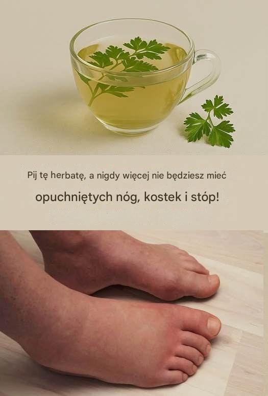 Herbata z pietruszki: naturalna ulga dla opuchniętych nóg, kostek i stóp