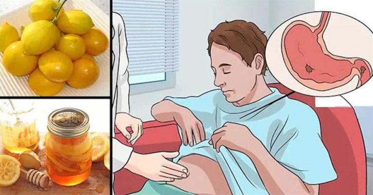 Cytrynowy trik na naturalne leczenie niestrawności